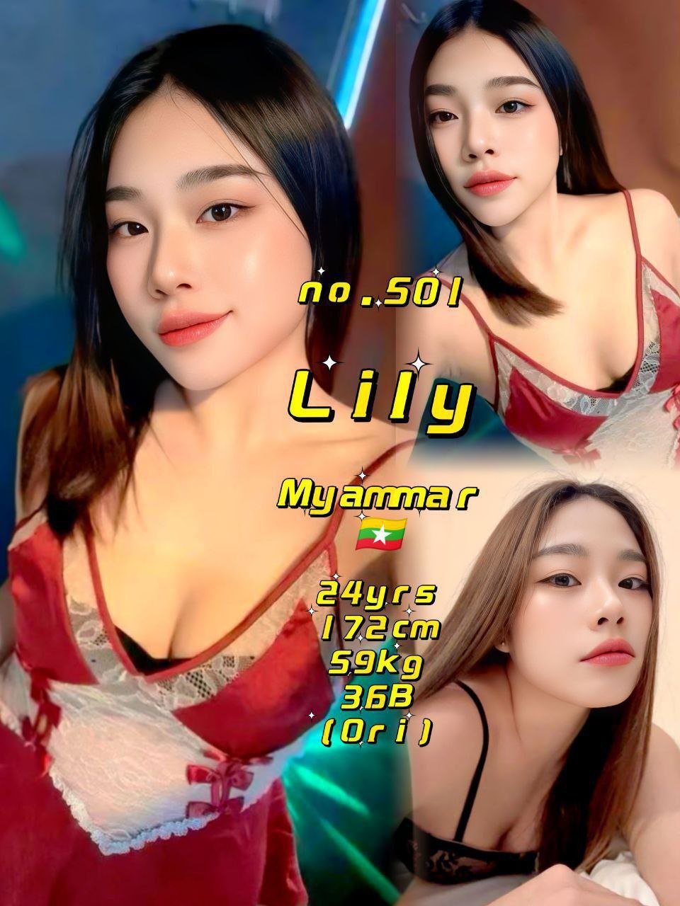 501 Lily JB Escort Model