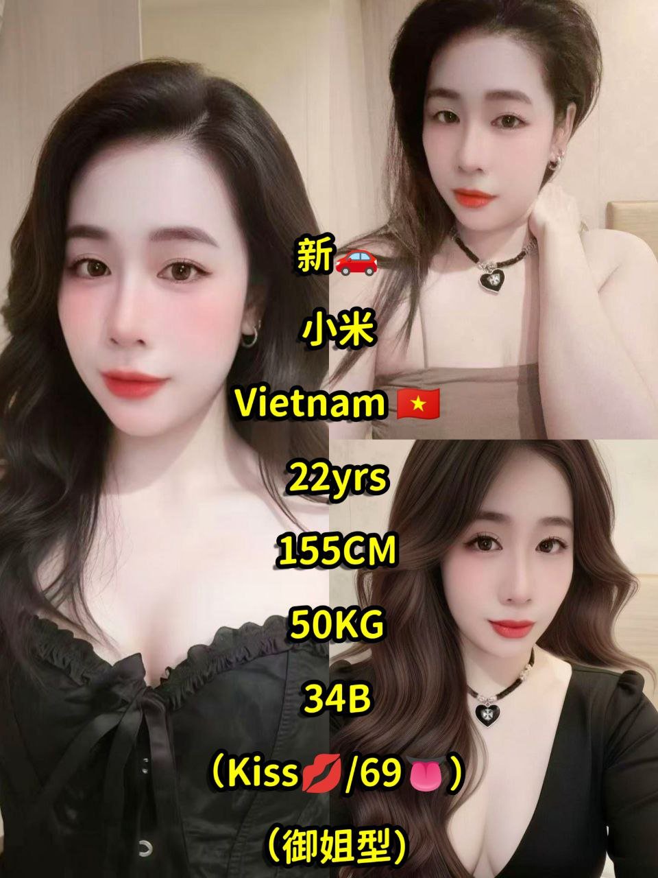 小米 JB Escort Model