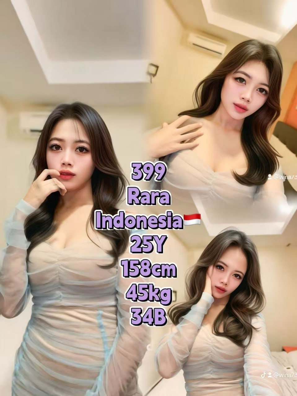 399 Rara JB Escort Model